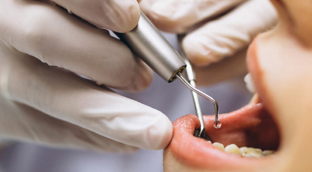 Dental-House_0000s_0001_Rehabilitacion Oral