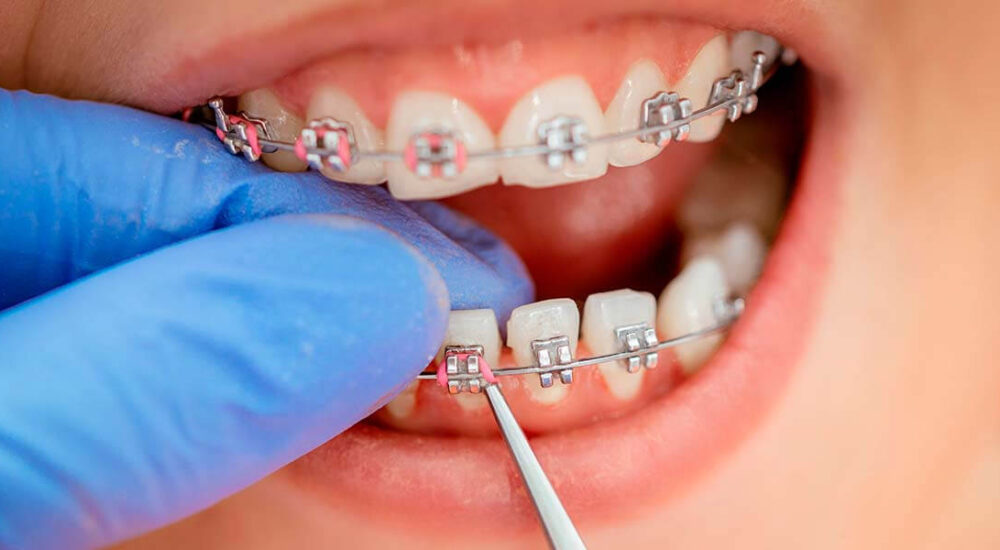 Dental-House_0000s_0003_Ortodoncia y Ortopedia Maxilar