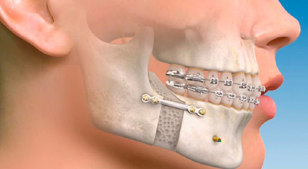 Dental-House_0000s_0004_Cirugia Oral y Maxilofacial